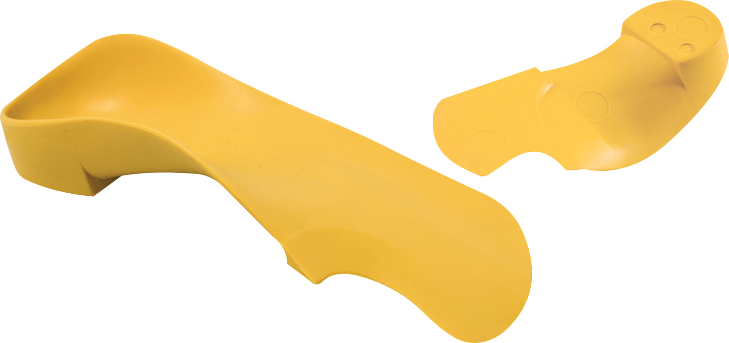 Quad A Severe Pes Cavus foot Supinator