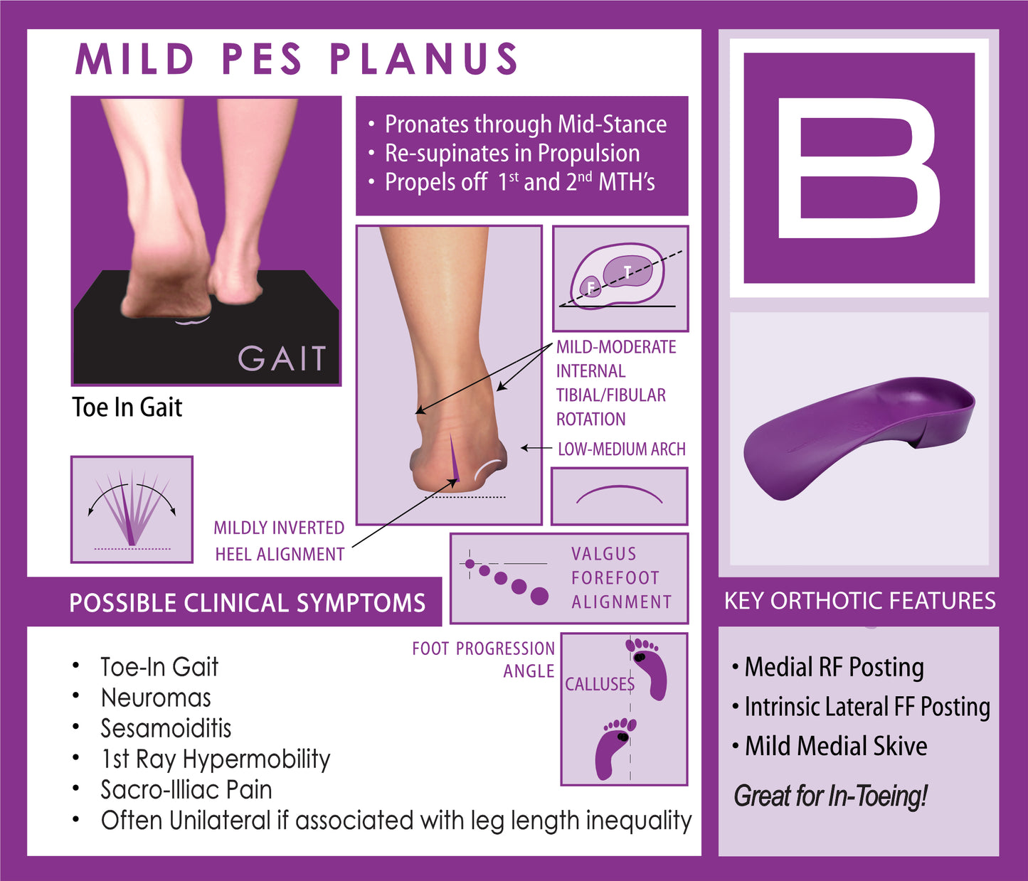 Quadrastep B Mild Pes Planus