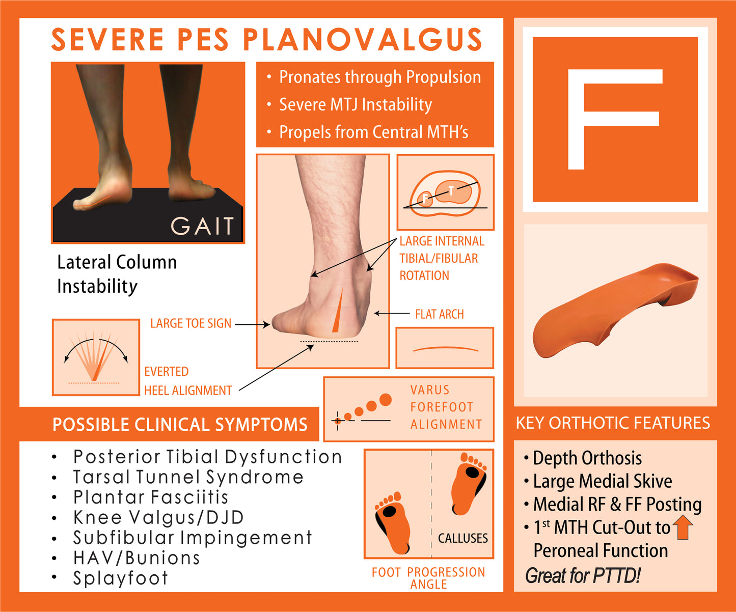 Quadrastep F Severe Pes Planovalgus