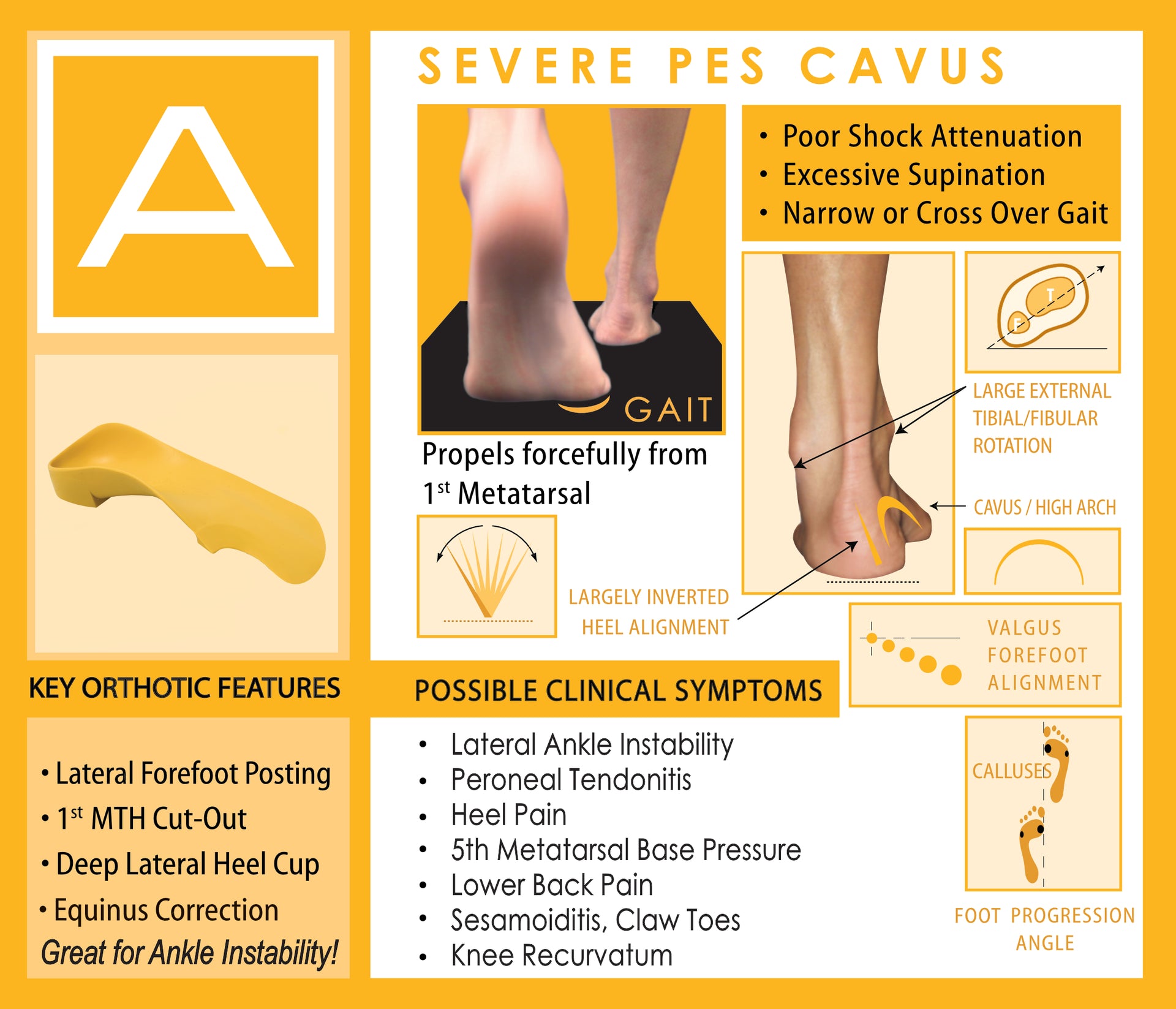 Quad A Severe Pes Cavus foot Supinator